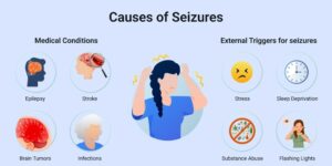 8 Possible Triggers of seizure activity