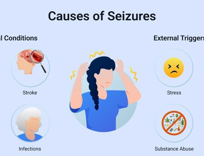 8 Possible Triggers of seizure activity