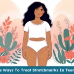 Dealing with stretch marks during puberty