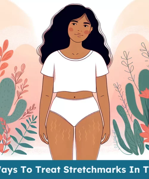 Dealing with stretch marks during puberty