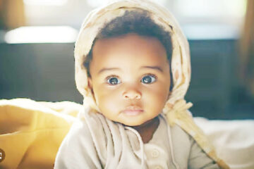 The girl with bulging eyes