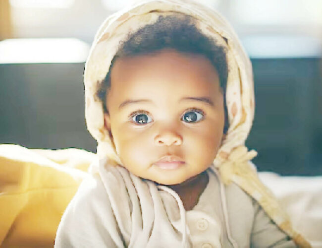 The girl with bulging eyes